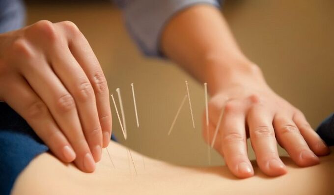 acupuncture don magance ƙananan ciwon baya