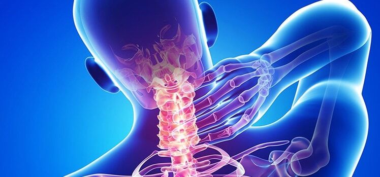 osteochondrosis na cervical kashin baya